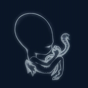 Sigur Ros - Ágætis Byrjun